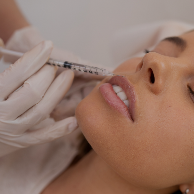Dermal Fillers
